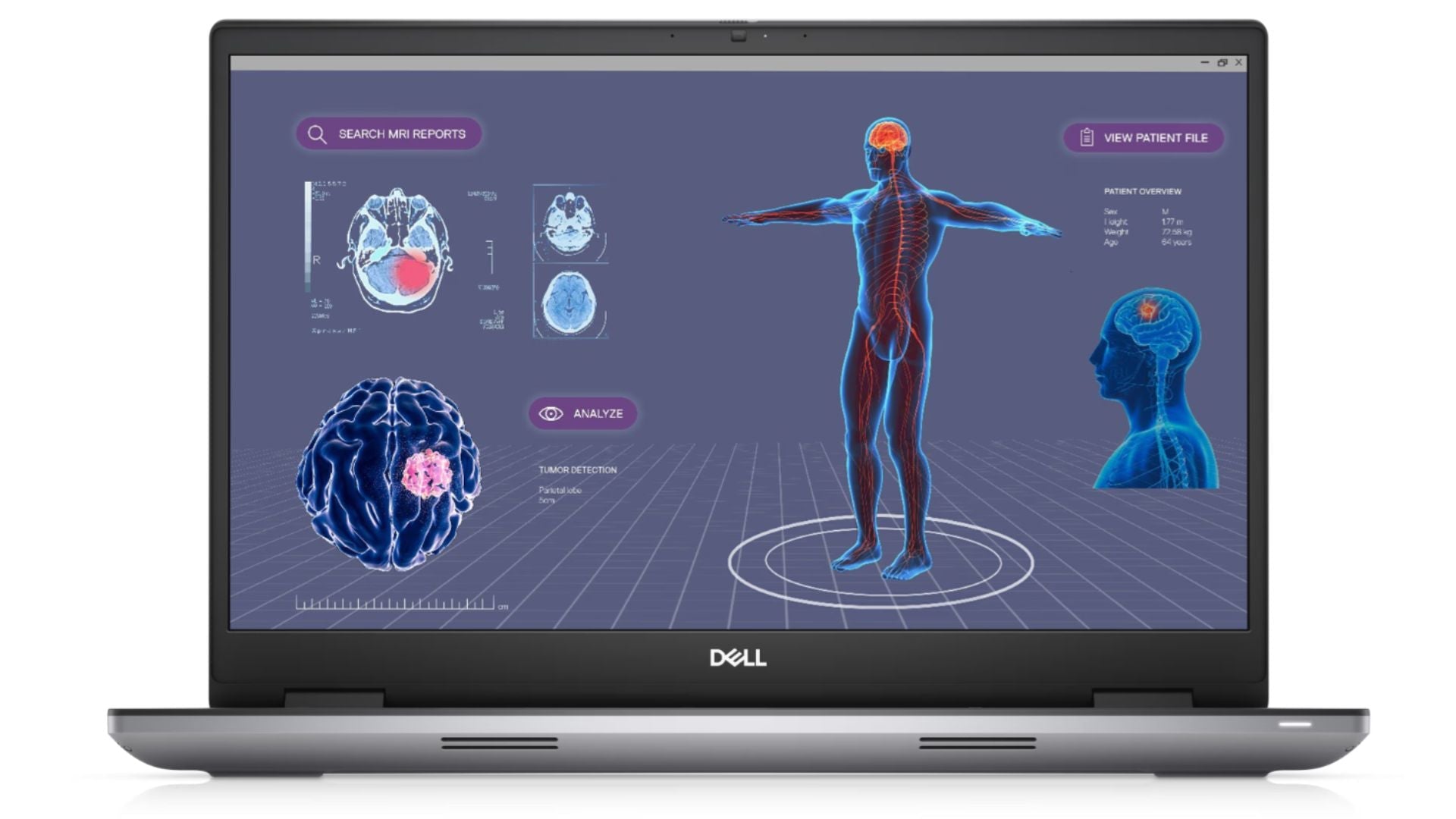 Dell Precision 7780 CAD Workstation Laptop i7-13850HX 17" FHD 32GB 512GB NVIDIA RTX 3500 Ada 12GB CAM /MIC - ProSupport 06-2027 (SR) Out of stock