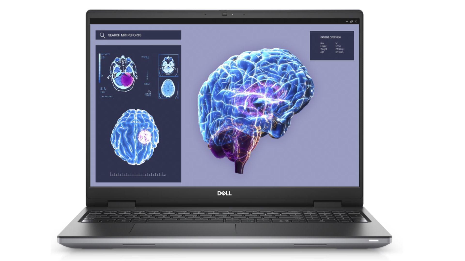 Dell Precision 7680 Workstation i5-13600HX 16" FHD 8GB 256GB Intel Graphics CAM/MIC Numeric keypad - Dell ProSupport 12/26 (MFR)